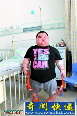 顺德3岁男童体重120斤远超95斤的妈妈重 智力比6岁小朋友高