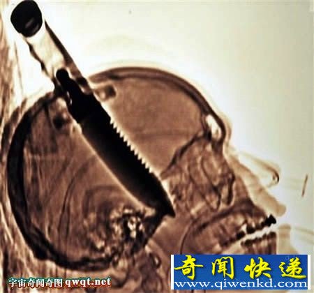 世界上不可思议的恶心记录:1分钟吃36只蟑螂