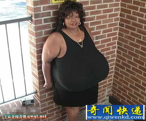 世界最大胸部女子天生豪乳重36斤 连续10年保持纪录(组图)