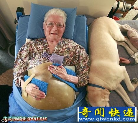 惊佩!靠人工呼吸器存活60年的瘫痪老妇
