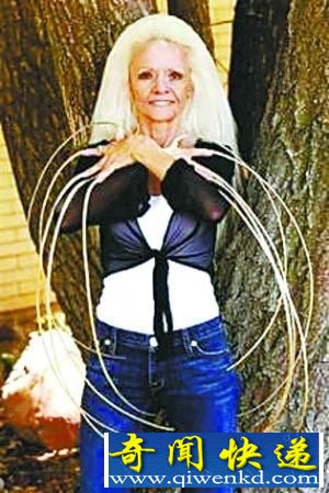 美妇女留30年长达0.9米指甲因车祸折断
