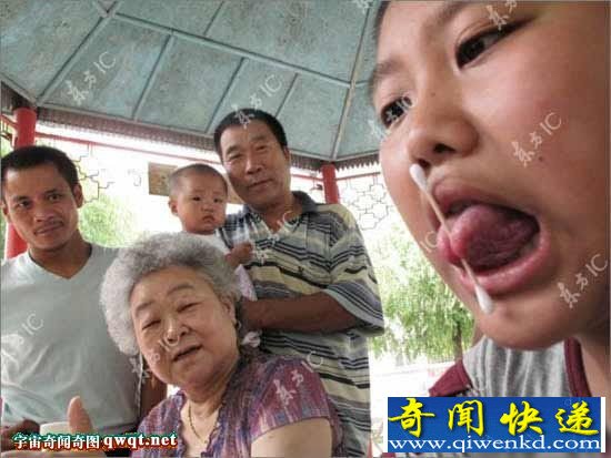 大庆一13岁男孩舌头分叉能夹物