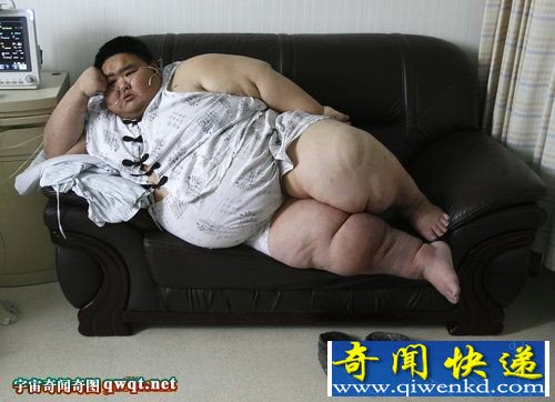 铁血网提醒您:点击可查看大图 中国第一胖”排尿将体内的腹水排出肚子鼓胀缓解