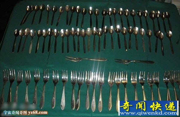 荷兰女子胃疼难忍 医生从其肚子里取出78把餐具