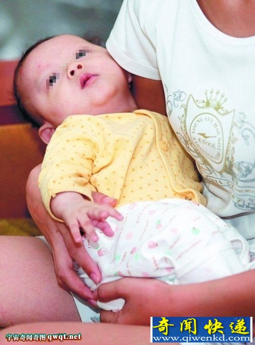 洛江婴儿成阴阳人 有男女生殖器