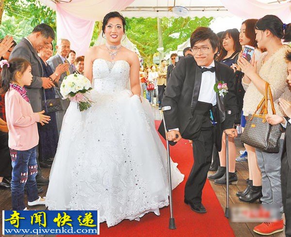 台湾连体兄弟35年前成功分割 弟弟迎娶美娇娘