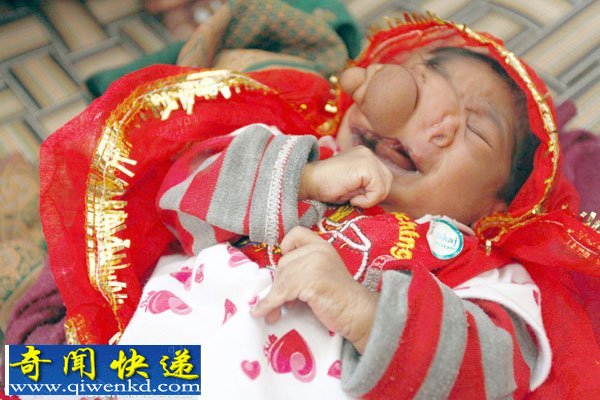 印度女婴因生来脸上就长有象鼻而受到民众的朝拜