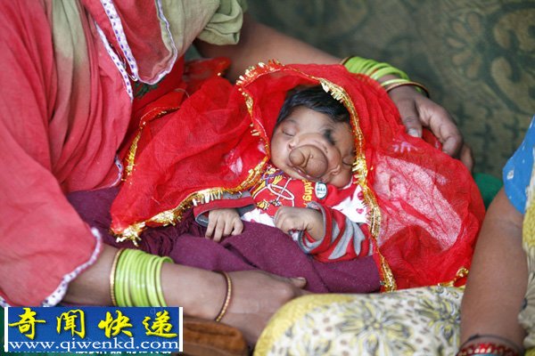 印度女婴因生来脸上就长有象鼻而受到民众的朝拜