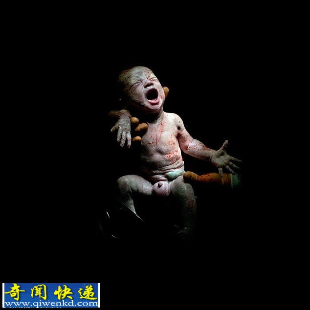 法国摄影师拍摄剖腹产婴儿出生的18秒瞬间