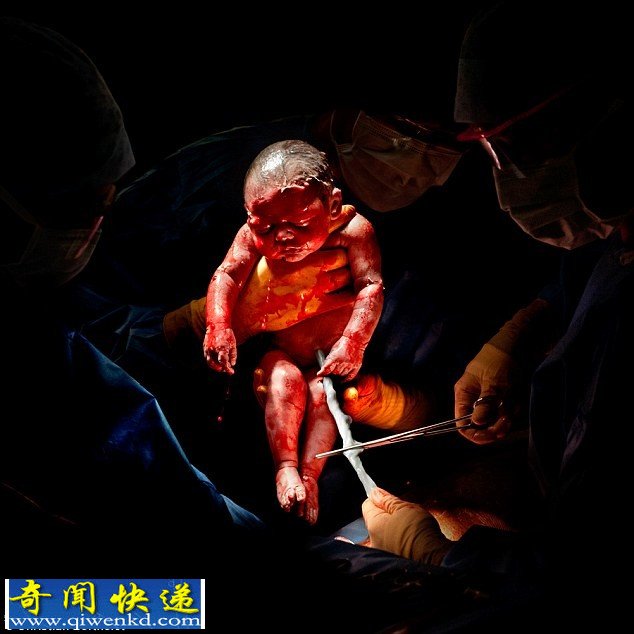 法国摄影师拍摄剖腹产婴儿出生的18秒瞬间