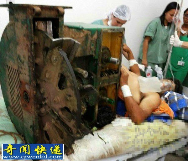 巴西:男子撞碎纸机 被切碎下半身送医急救