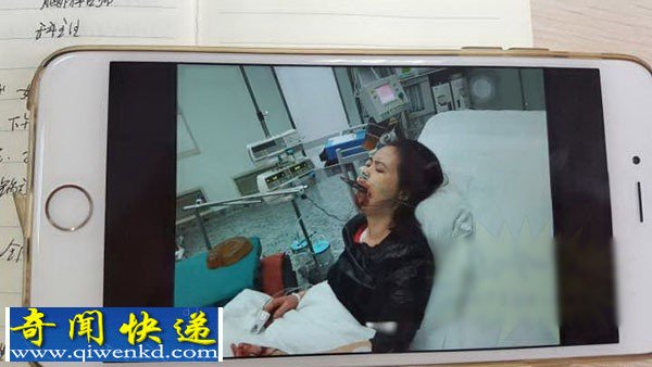 东莞女子将30厘米长锅铲插入食道 怀疑是否精神异常?