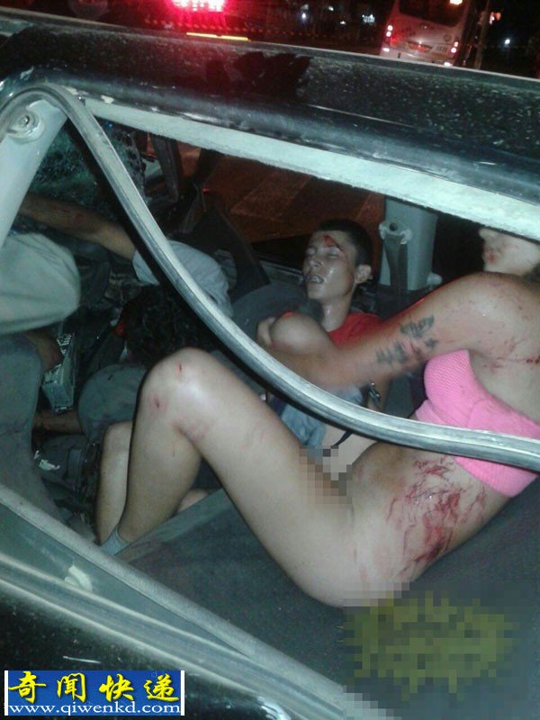 惨烈尴尬车祸现场:赤身男女车震XX时撞车人重伤