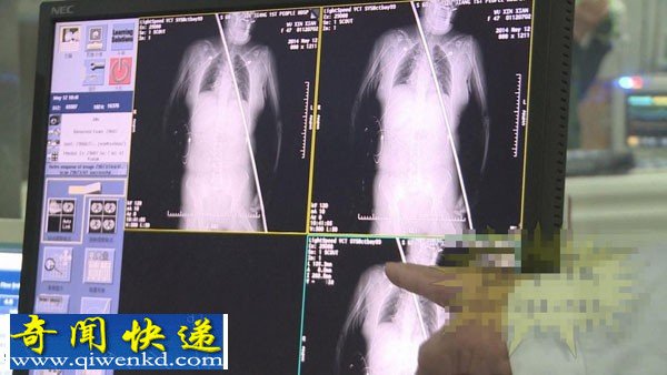 女工失足高空坠落 被钢筋穿身而过(抢