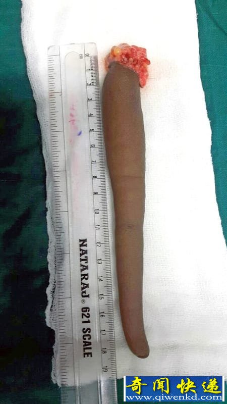 ӡкഺھβ 20cm