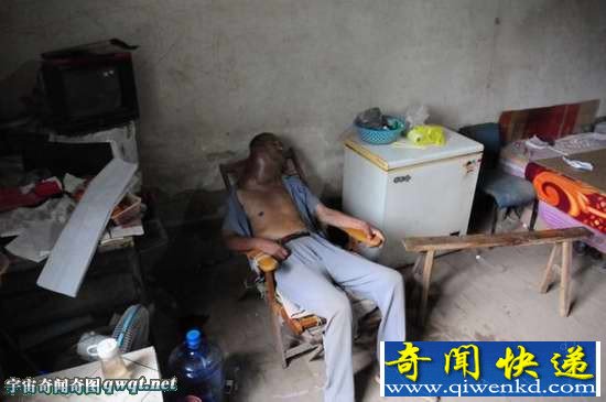 山东聊城:老汉得怪病肿瘤比头大无力治疗陷困境