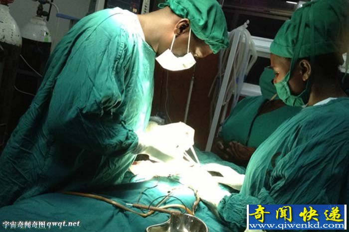 乌干达孕妇产下4手4脚男婴 系罕见寄生双胞胎