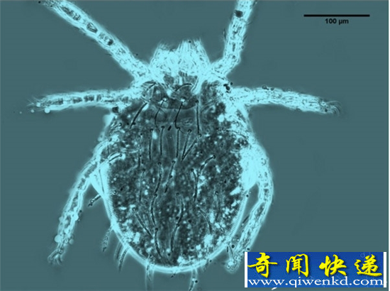 比头皮屑还小的毒虫 被咬的人死亡率超过60%