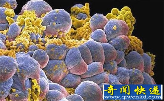 科学家发现治疗癌症新方法 副作用极小