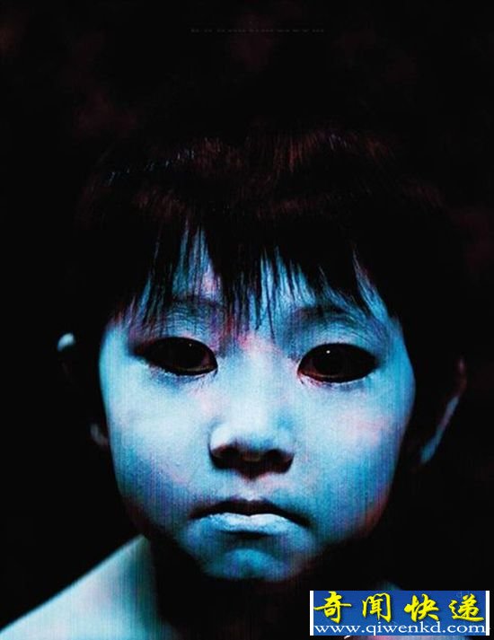 阴阳眼是真的吗?揭秘阴阳眼出现的原理