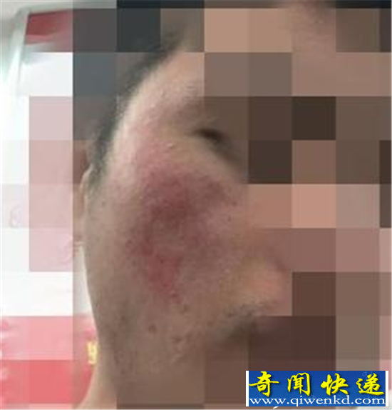 多名大学生毁容 参加丧尸跑活动被商家坑惨