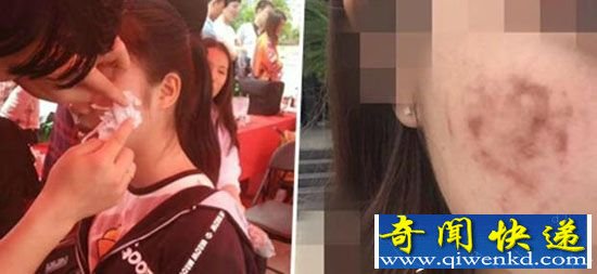 多名大学生毁容:涉事商场居然杜绝负责?