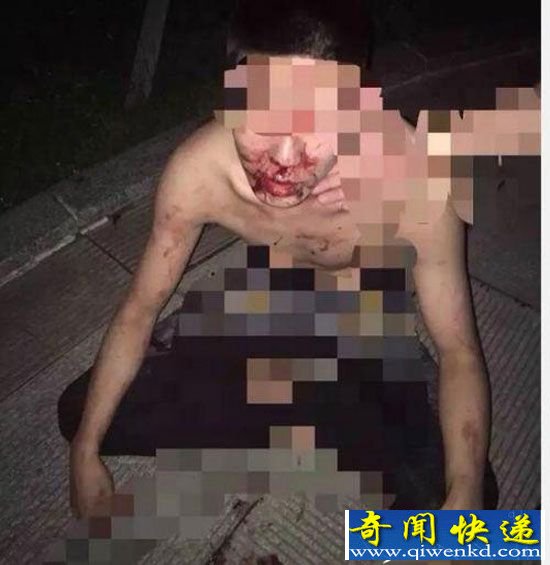高考生大学内夜跑遭老师保安围殴 血肉模糊