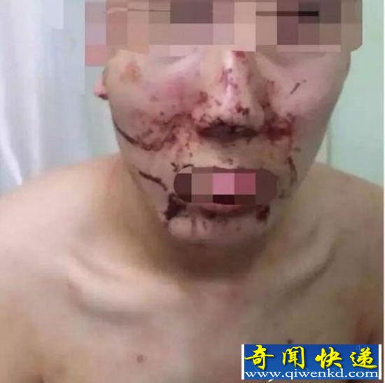 高考生大学内夜跑遭老师保安围殴 血肉模糊