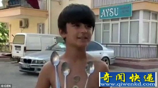 土耳其男孩被称小万磁王 身体可吸附金属