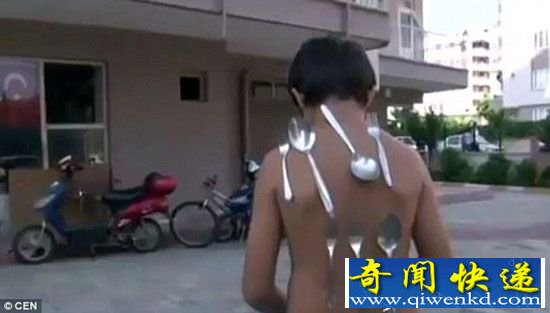 土耳其男孩被称小万磁王 身体可吸附金属
