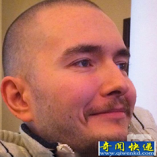 俄罗斯电脑工程师 成第一个更换头颅的人