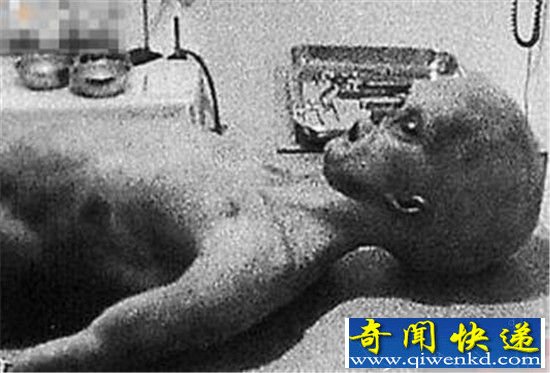 美国登月第一人临死前一句话曝光 51区三眼女尸
