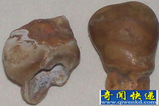 中国现17.8万年前牙齿化石 证明人类起源