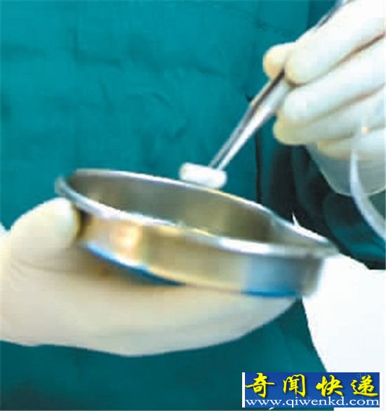 3D打印人工血管 还实现了与原有血管在体内的完美结合?