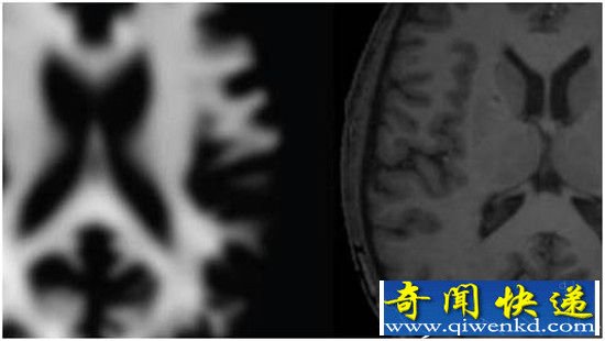 英国研发“深度学习机” 能够自动识别大脑年龄