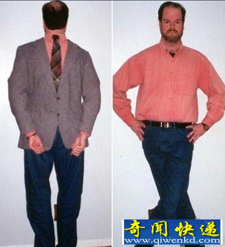 橡皮筋先生