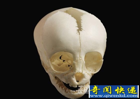 黑头蜘蛛猴的颅骨