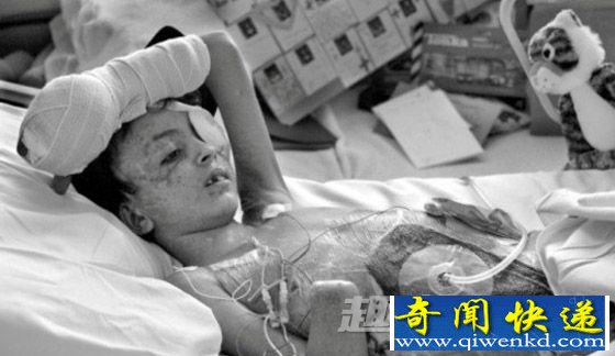 狮心手术