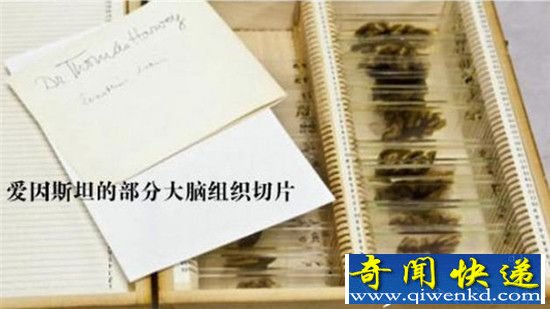 爱因斯坦的大脑失踪真相:被切成1000片和240块