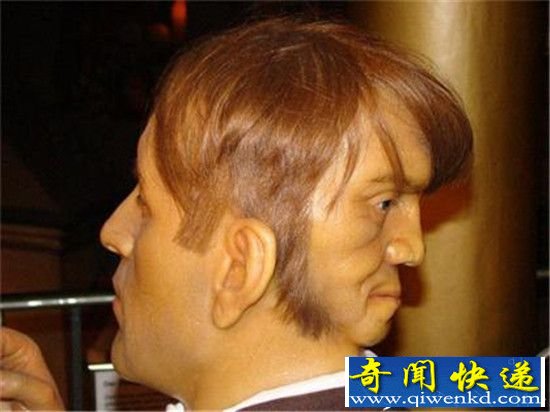 双面人为何拥有两张脸 全世界只有三人