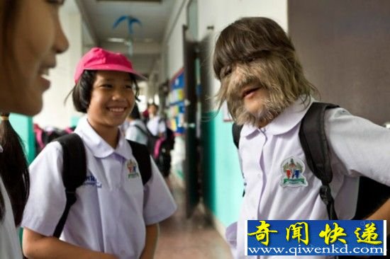 盘点全球最诡异的恐怖疾病 爱丽丝梦游仙境症上榜