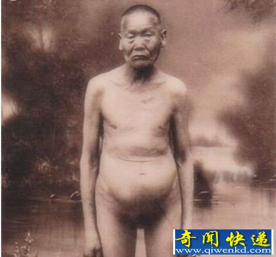 解密太监被阉割后的“性生活”