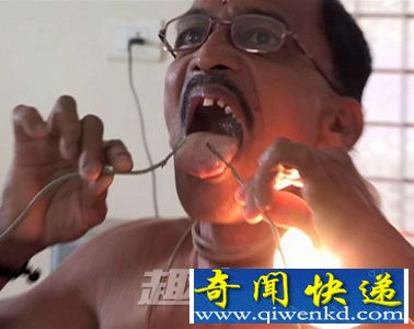 身体过电而不死之人