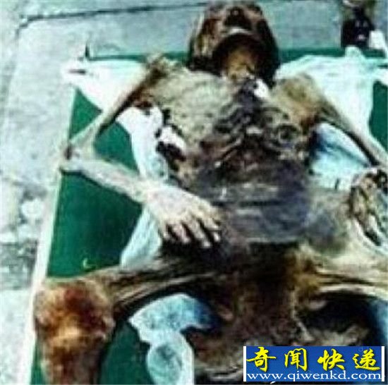 千年木乃伊意外怀孕 生出女婴存活72小时