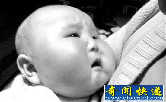 农妇生下八肢怪婴 罕见畸形惊呆医生