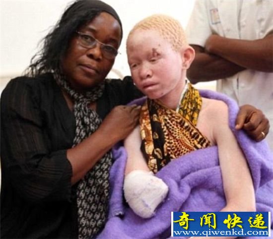 ���ǰ׻�����������֫�� ʬ�岿������49��