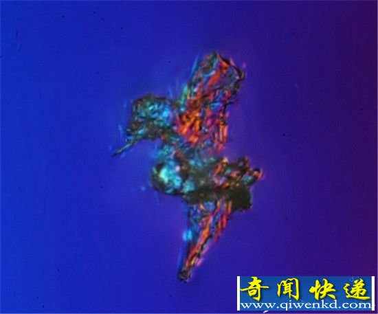 北京雾霾在显微镜下的样子 看完你还敢呼吸?