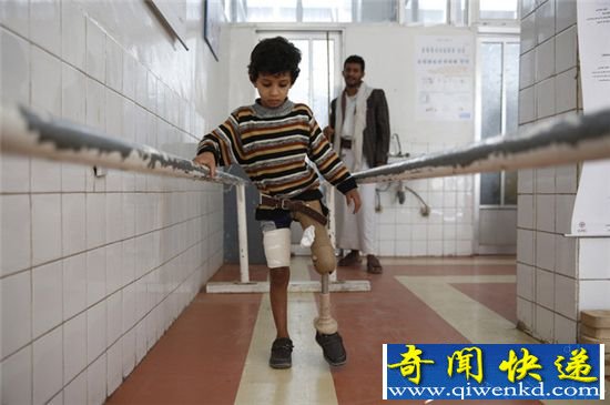 也门的生不如死:婴儿5月大被活生生饿死