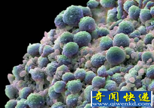 未来科技:纳米机器人可精确找到癌细胞