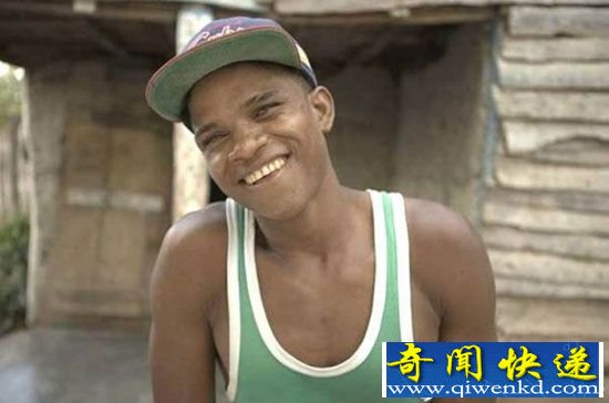 少年患罕见病12岁女变男 全球奇特变性人大全